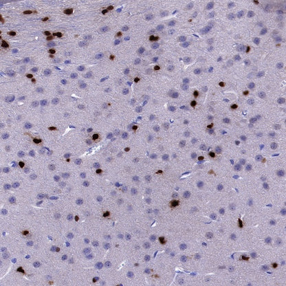 Olig2 Recombinant Rabbit mAb (SDT-648-155)