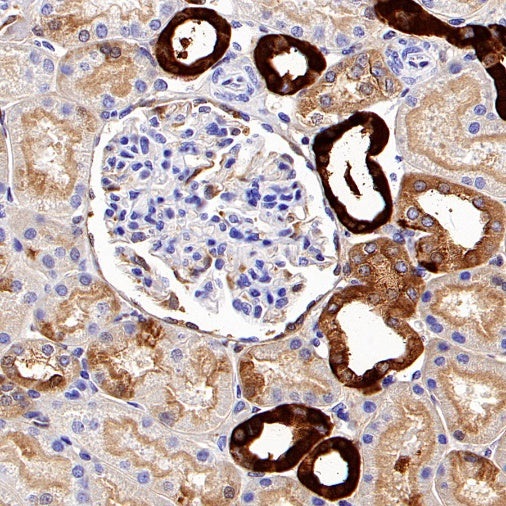 Calbindin Recombinant Rabbit mAb (S-774-378)