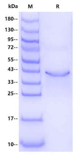 Human ADAM22 Protein, His Tag