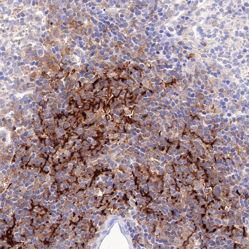 SQSTM1/p62 Recombinant Rabbit mAb (S-R346)