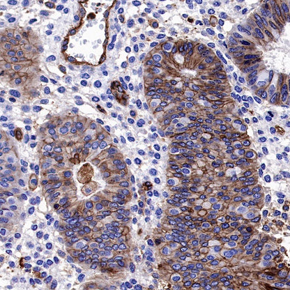 HLA-A Rabbit Polyclonal Antibody