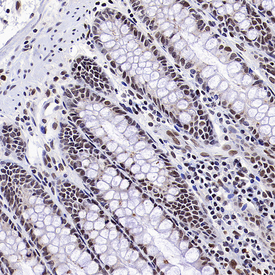 RFX5 Recombinant Rabbit mAb (S-3628-50)