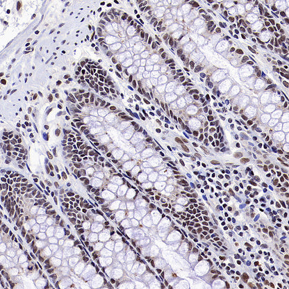 RFX5 Recombinant Rabbit mAb (S-3628-50)