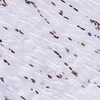 NRF1 Recombinant Rabbit mAb (S-2409-103)