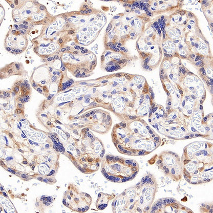 IFIH1 Recombinant Rabbit mAb (S-2413-49)