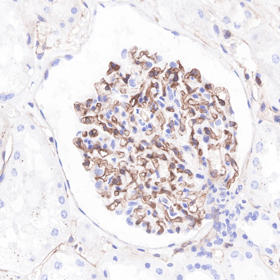 Beta 2 microglobulin Recombinant rabbit mAb (SDT-096-100)