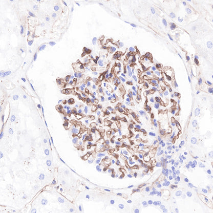 Beta 2 microglobulin Recombinant rabbit mAb (SDT-096-100)