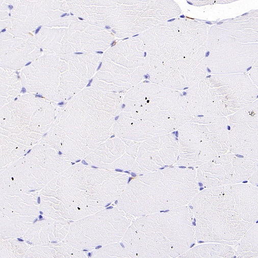 Sialoadhesin/CD169 Recombinant Rabbit mAb (SDT-3228-8)