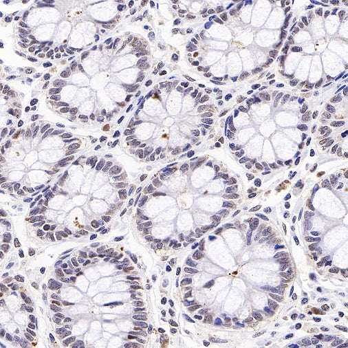 E2F4 Recombinant Rabbit mAb (S-586-214)