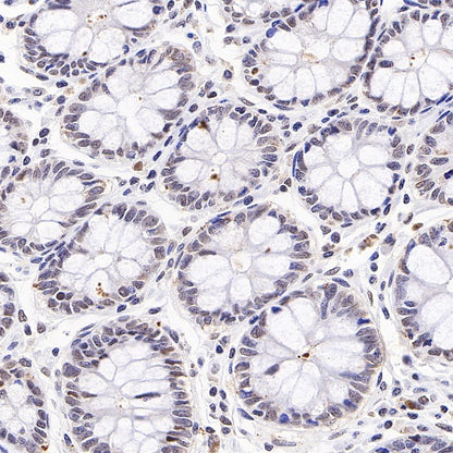 E2F4 Recombinant Rabbit mAb (S-586-214)