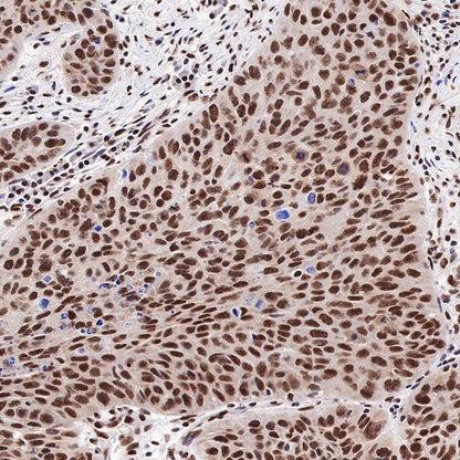 TDP43 Recombinant Rabbit mAb (S-R354)