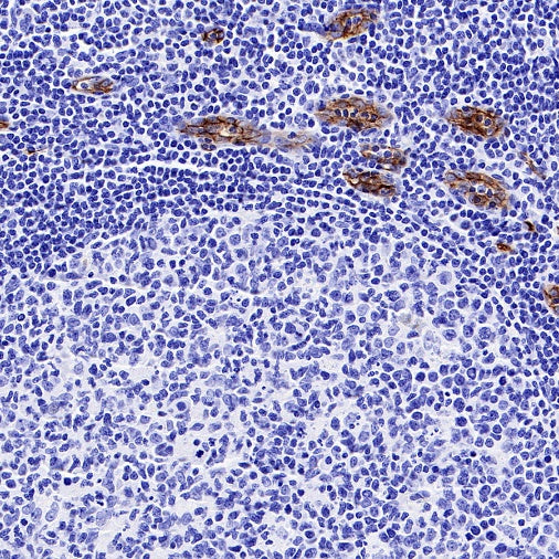 Claudin 5 Recombinant Rabbit mAb (SDT-R322)