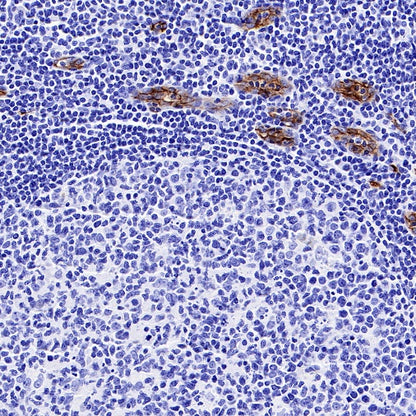 Claudin 5 Recombinant Rabbit mAb (SDT-R322)