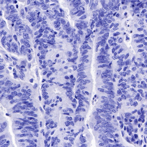 S-RMab® SOX10 Recombinant Rabbit mAb (SDT-R233)