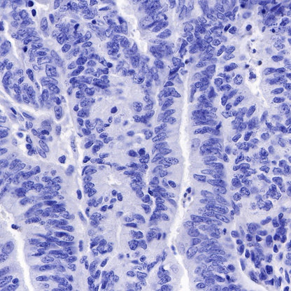 S-RMab® SOX10 Recombinant Rabbit mAb (SDT-R233)