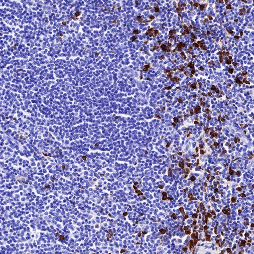 Human IgG1 F(c) Recombinant Rabbit mAb (S-447-20)