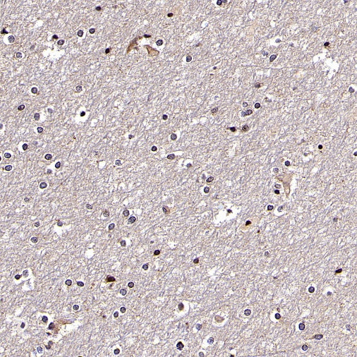 SCAMP1 Rabbit Polyclonal Antibody