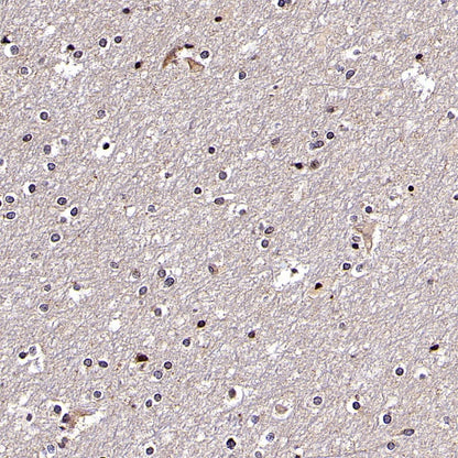 SCAMP1 Rabbit Polyclonal Antibody