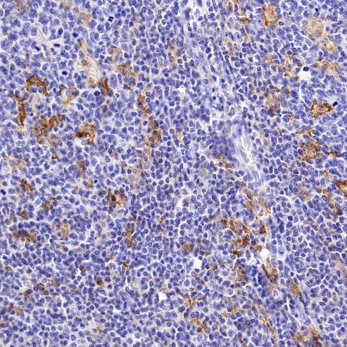 Lymphocyte antigen 75/CD205 Recombinant Rabbit mAb (S-2707-25)