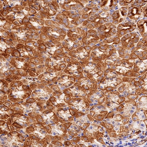 PBR/TSPO Recombinant Rabbit mAb (S-607-19)