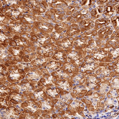 PBR/TSPO Recombinant Rabbit mAb (S-607-19)