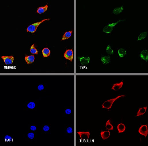 TYK2 Recombinant Rabbit mAb (S-2740-165)