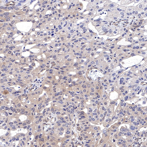 Akt (pan) Recombinant Rabbit mAb (S-652-20)