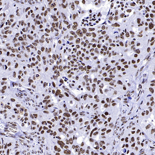 WTAP Recombinant Rabbit mAb (S-2741-49)