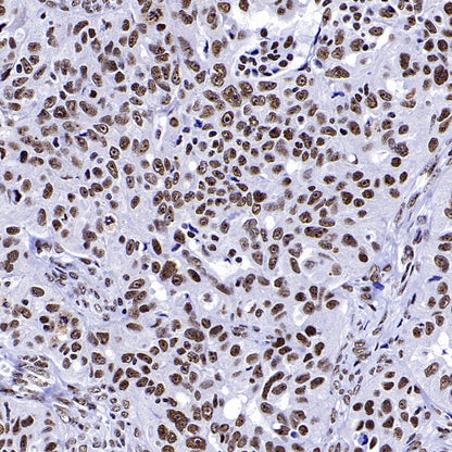 WTAP Recombinant Rabbit mAb (S-2741-49)