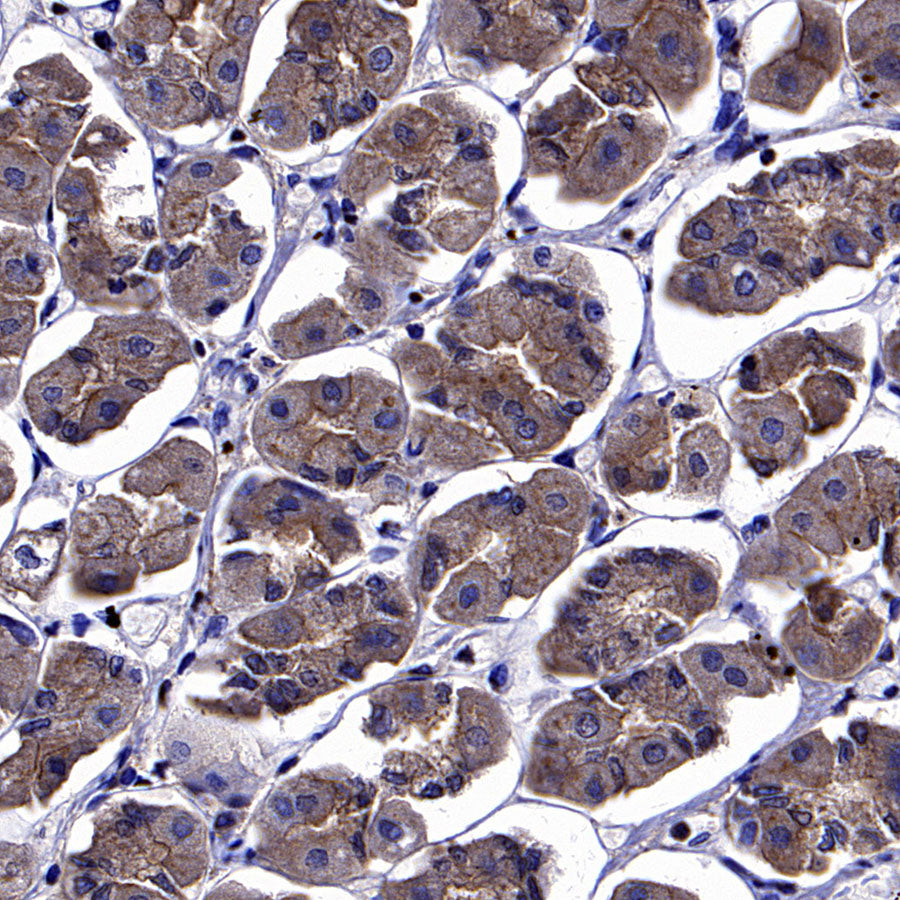 ARF6 Recombinant Rabbit mAb (S-4283-62)