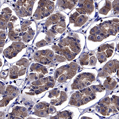 ARF6 Recombinant Rabbit mAb (S-4283-62)