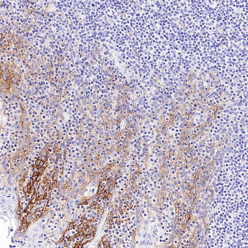 CD44v6 Mouse mAb (S-945-76)