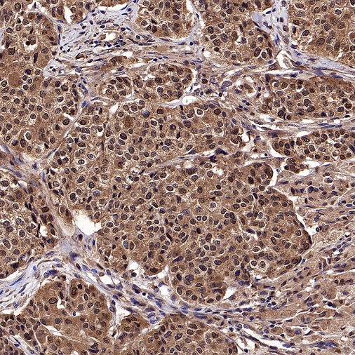 LMPTP Rabbit Polyclonal Antibody