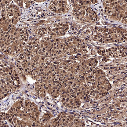 LMPTP Rabbit Polyclonal Antibody