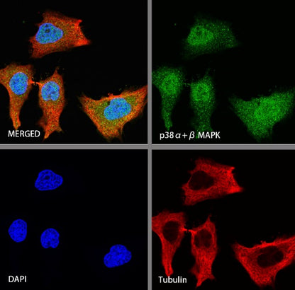 p38α MAPK+p38β MAPK Recombinant Rabbit mAb (S-1300-102)
