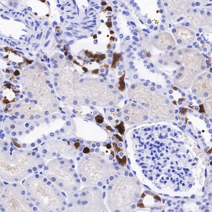IL-18 Recombinant Rabbit mAb (S-2142-2)