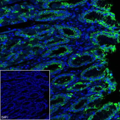 MUC5AC Recombinant Rabbit mAb (SDT-2630-23)