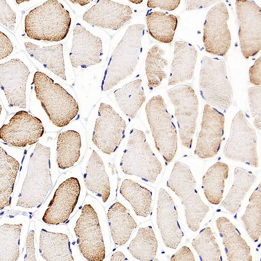 NDUFB8 Recombinant Mouse mAb (S-M0007)
