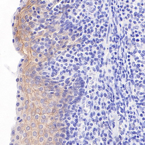 S-RMab® ErbB3 Recombinant Rabbit mAb (SDT-991-10)