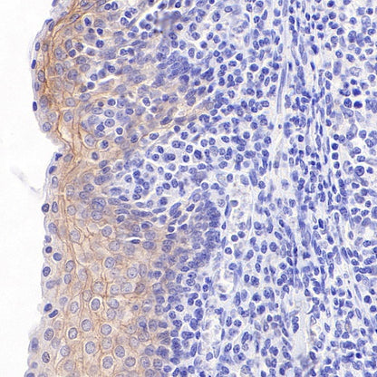S-RMab® ErbB3 Recombinant Rabbit mAb (SDT-991-10)
