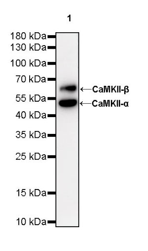 CaMKII-α/β Recombinant Rabbit mAb (S-R329)