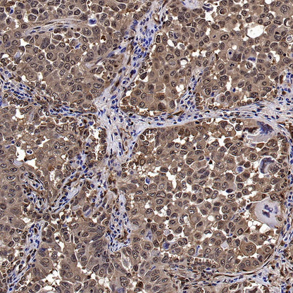 Erk1/2 Recombinant Rabbit mAb (S-3178)