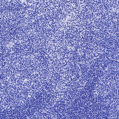 MUC17 Recombinant Rabbit mAb (SDT-3951-108)