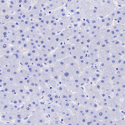 CGB/HCG-β Recombinant Rabbit mAb (SDT-228-46)
