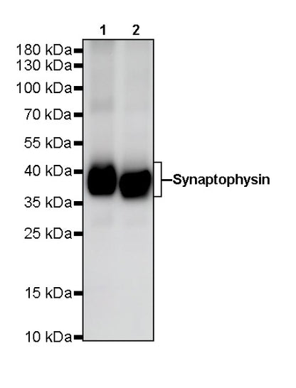 Synaptophysin Recombinant Rabbit  mAb (SDT-137-21)