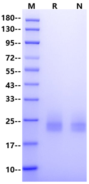 CD7 His Tag Protein, Mouse