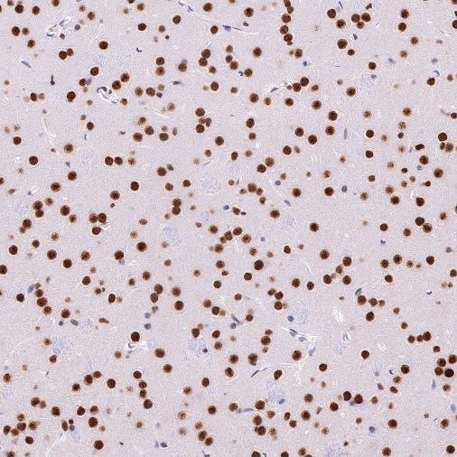 APE Recombinant Rabbit mAb (S-R349)