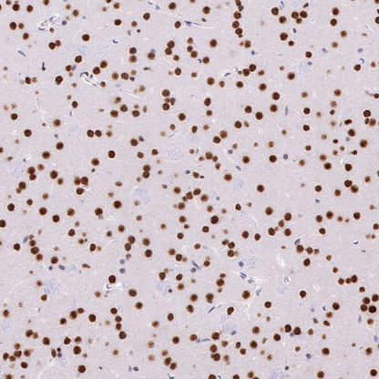 APE Recombinant Rabbit mAb (S-R349)