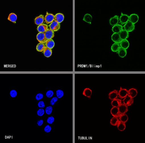 PRDM1/Blimp1 Recombinant Rabbit mAb (S-1972-3)