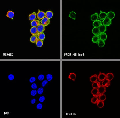 PRDM1/Blimp1 Recombinant Rabbit mAb (S-1972-3)
